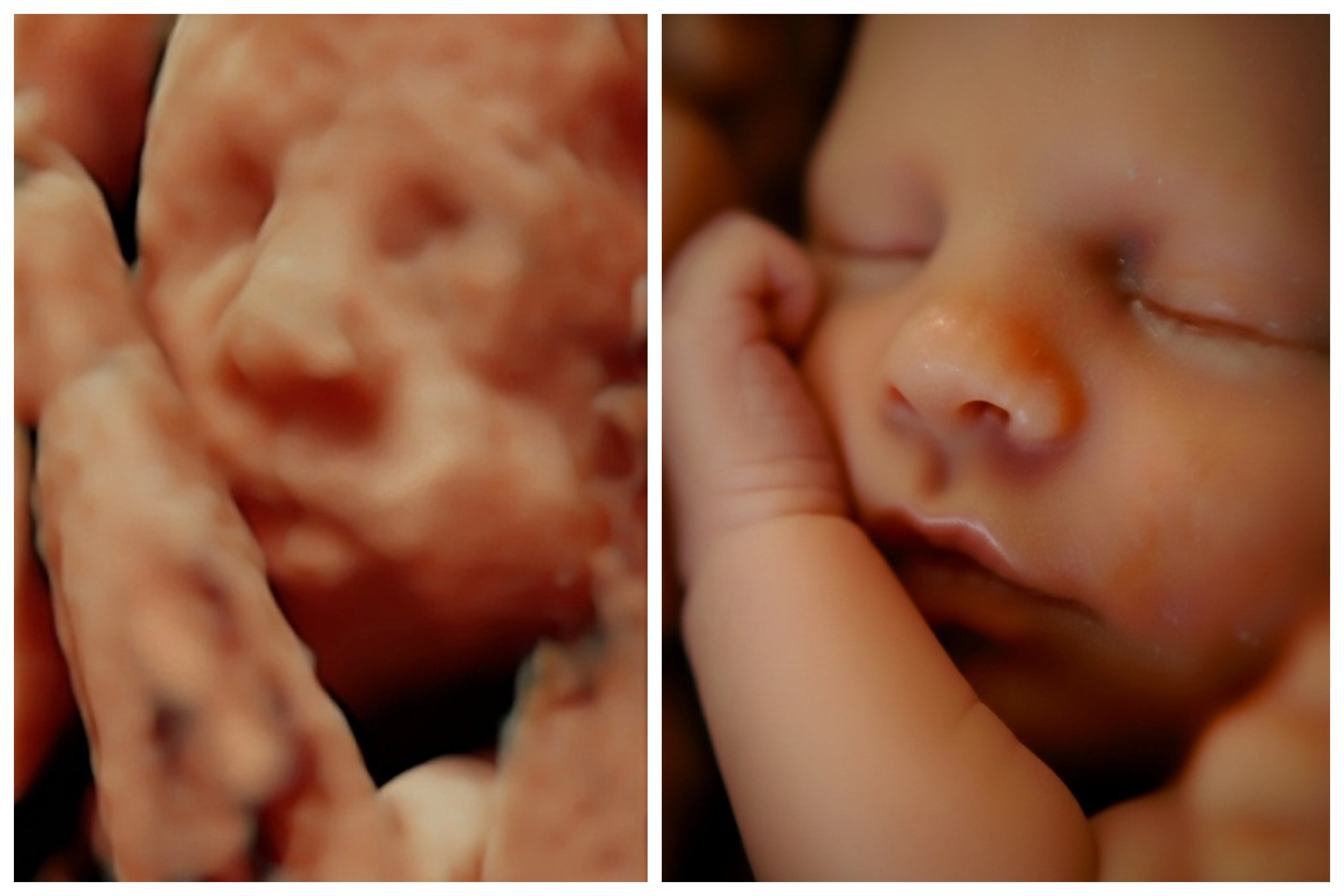 Imagen 8K HD de bebé antes de nacer - Econatal