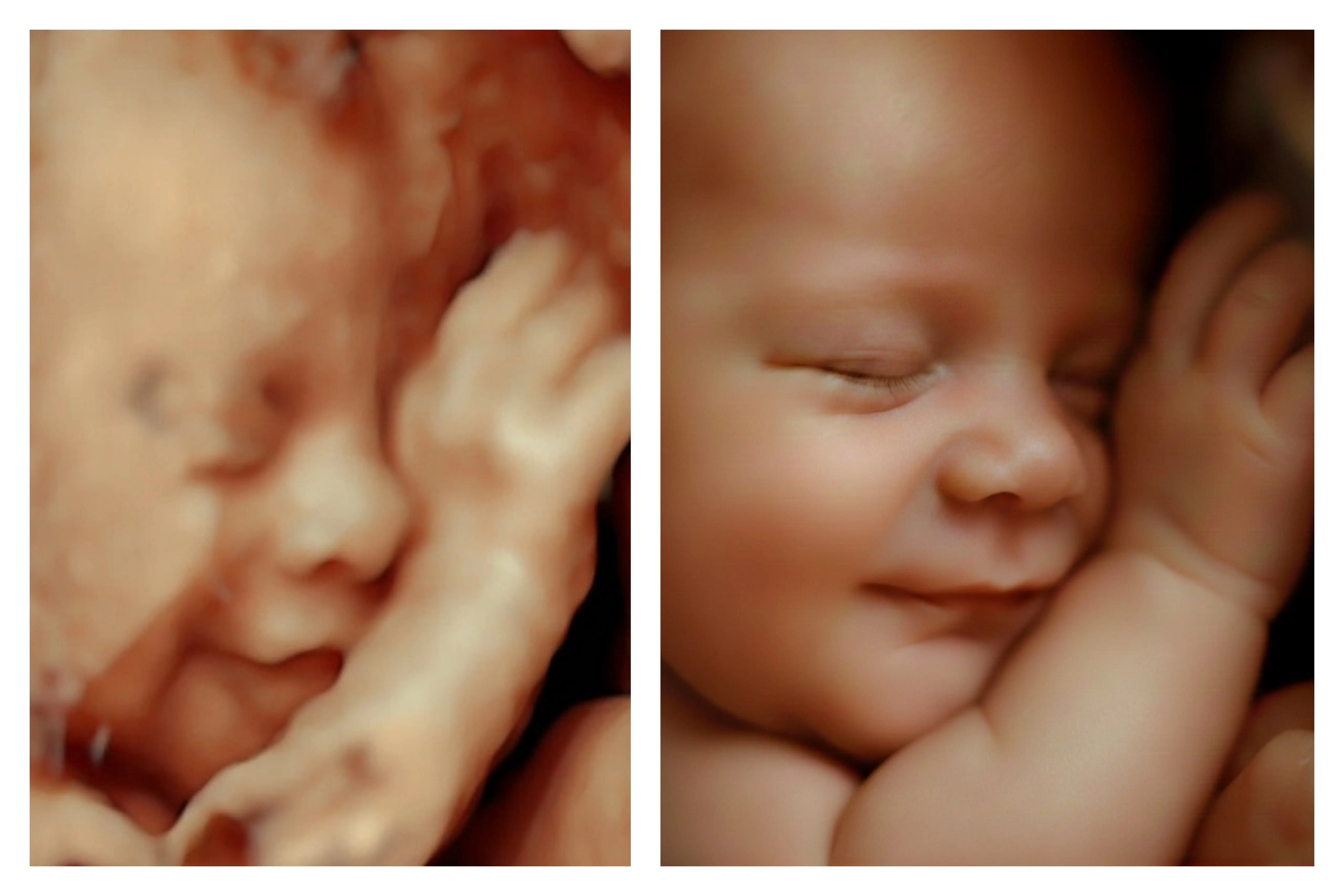 Procesamiento 8K de ecografía emocional - Econatal