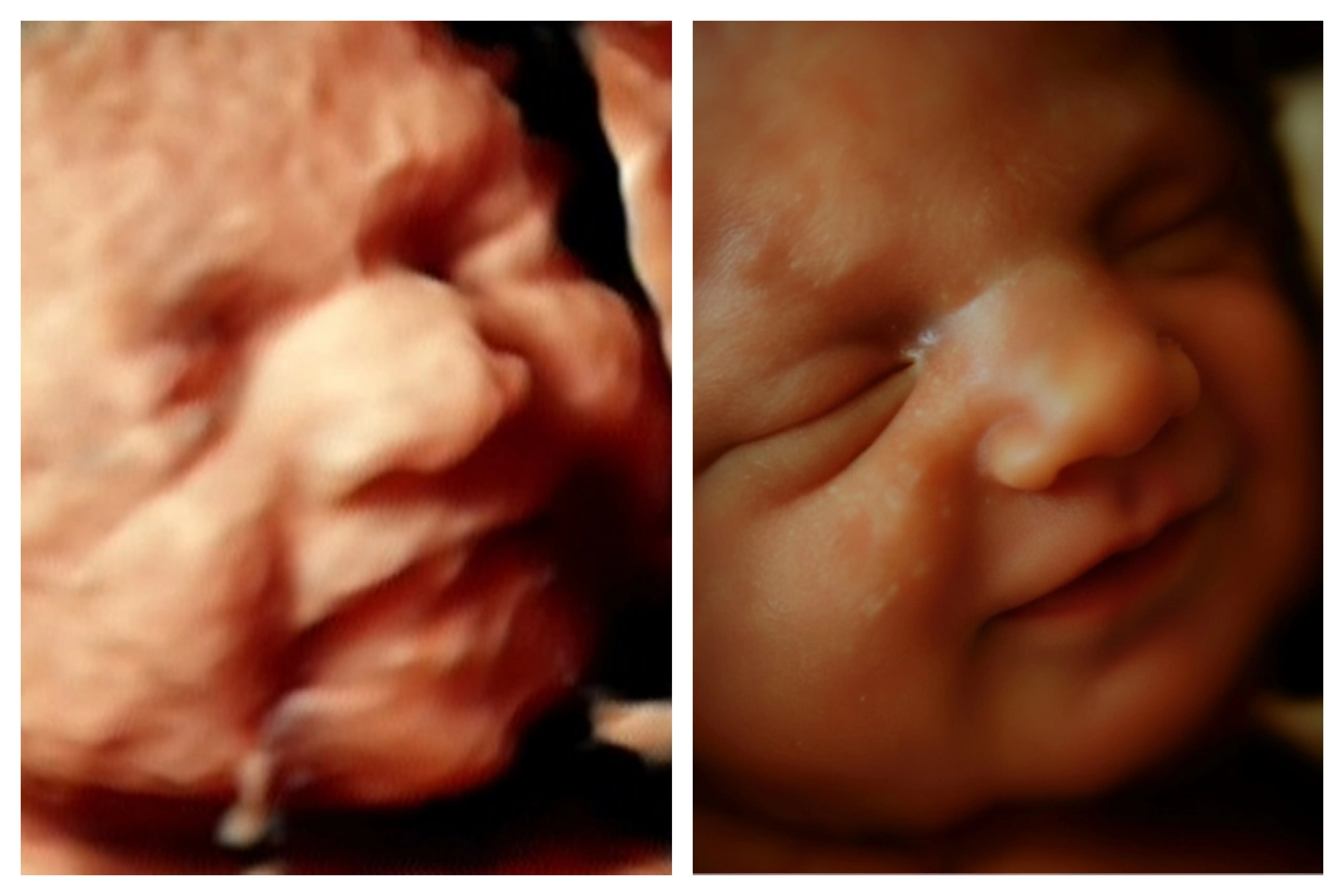 Detalle hiperrealista de bebé en 8K - Econatal