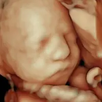 Resultado de ecografía 8K con nitidez extrema en Econatal