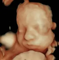 Detalle facial de bebé en ecografía 8K HD-Live