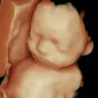 Captura de primeras sonrisas en ecografía emocional 8K