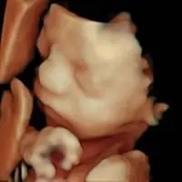 Calidad certificada de ecografía 5D y 8K en Econatal