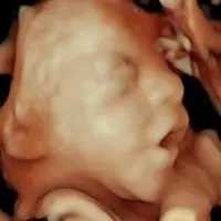 Ecografía 5D con nitidez extrema - Econatal