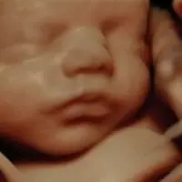 Sesión de ecografía 5D en Galicia y Baleares - Econatal