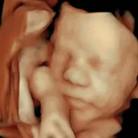 Sesión de ecografía emocional 5D